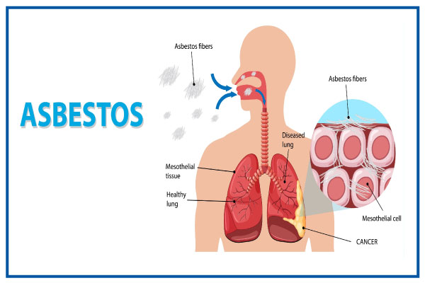 Cons of Asbestos Inhalation