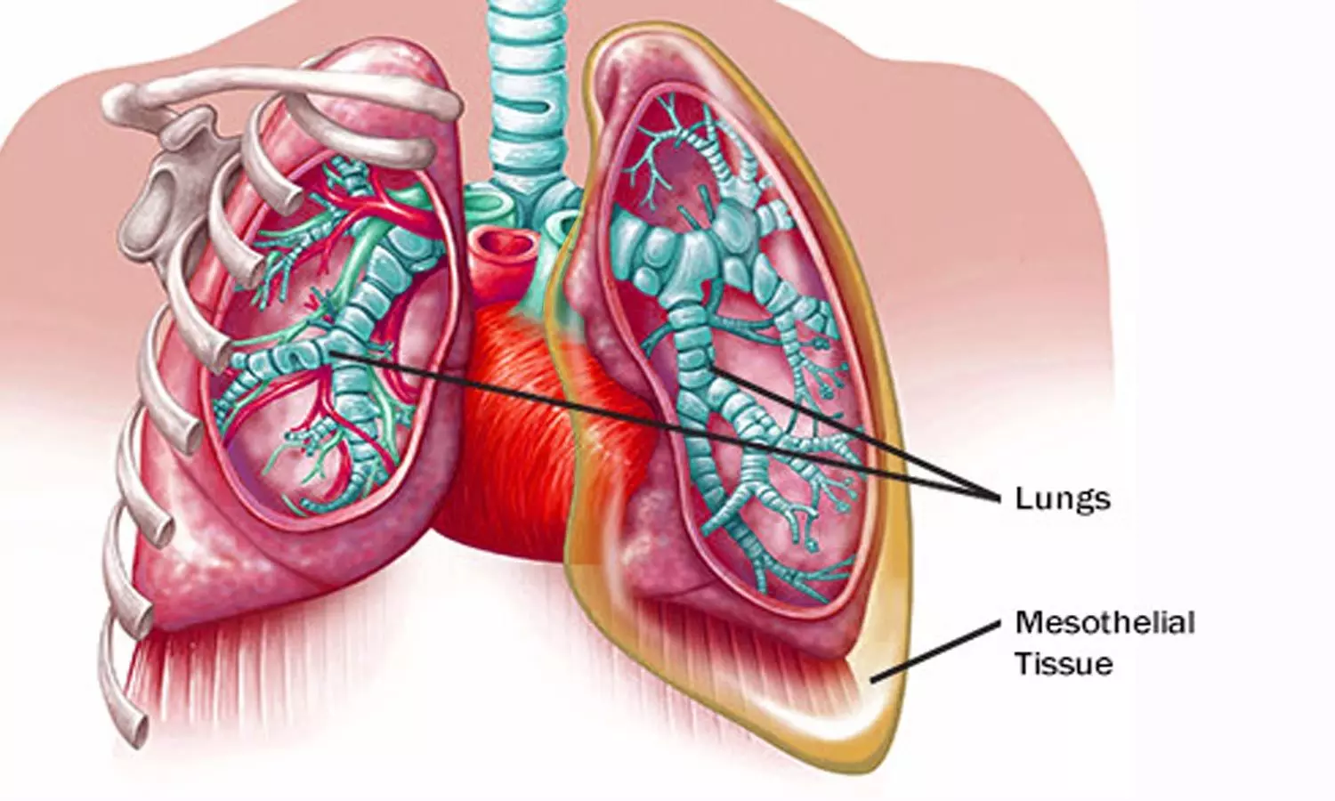 Symptoms and signs of Mesothelioma