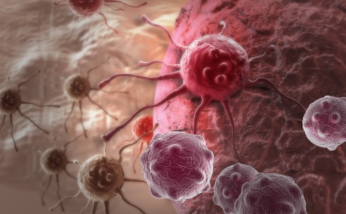 Advances in Fine-Tuning 3D Lab-Grown Mini-Tumors for Cancer Research