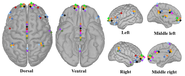 Neurological mechanisms facilitating cognitive focus in noisy environments