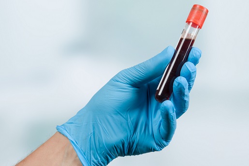 Simple blood test ability to predict severity of COPD exacerbation